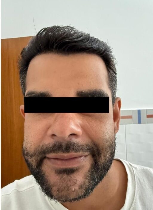 Depois